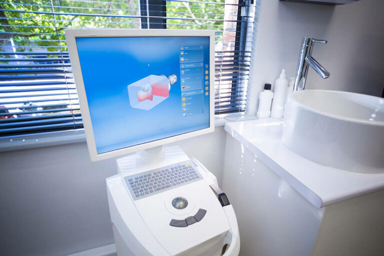 picture of a intraoral scanner in dental office