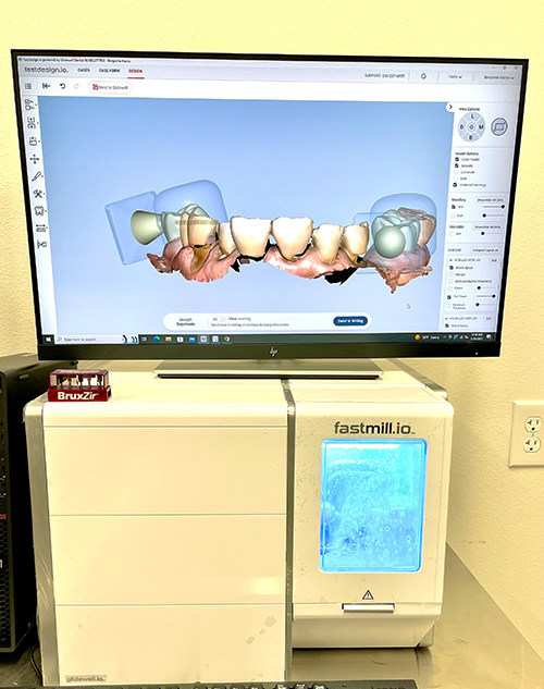 glidewell fastmill dental technology