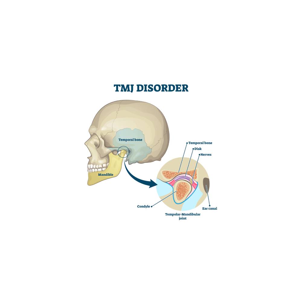 TMJ disorder vector illustration