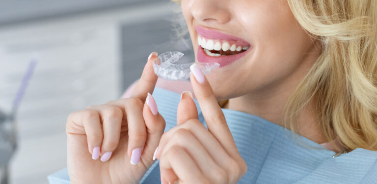 patient inserting clear aligner onto top row of teeth