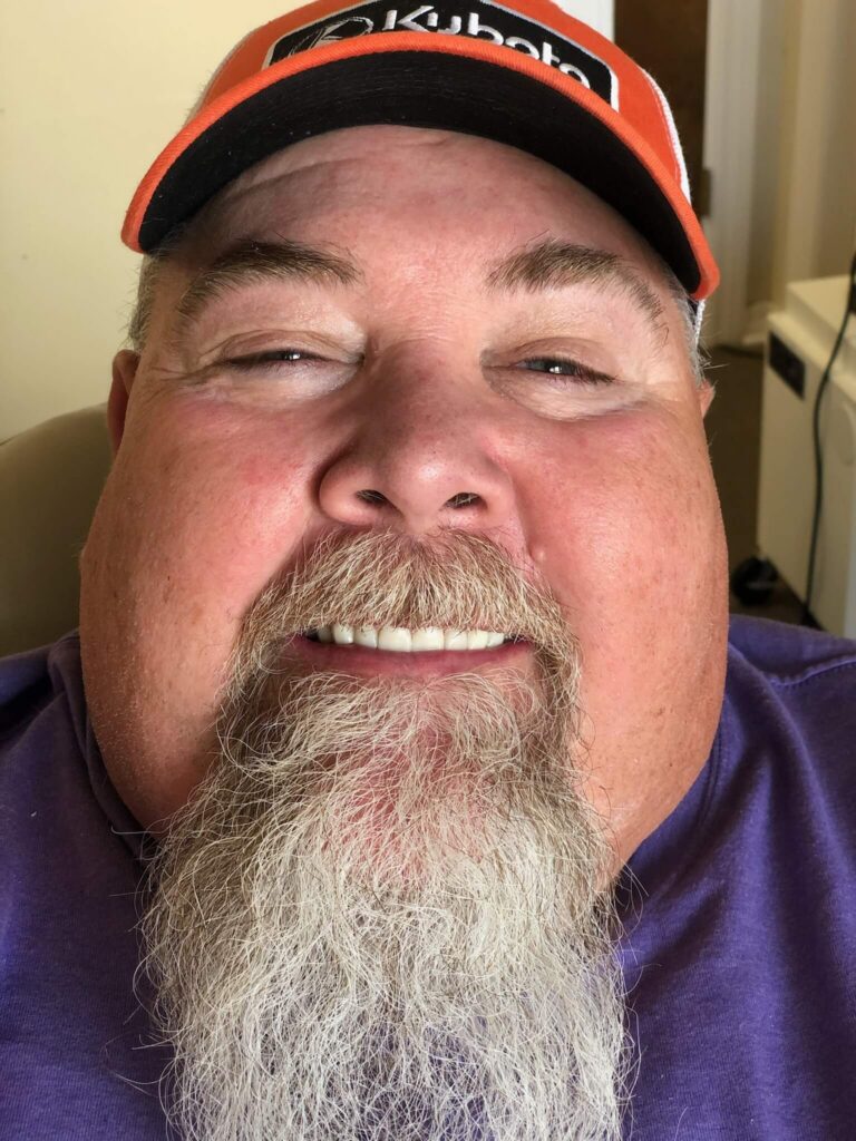 Dental Crown Patient in Shreveport, LA at Shreveport Dental Solutions
