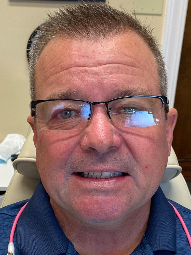 Dental Crown Patient in Shreveport, LA at Shreveport Dental Solutions