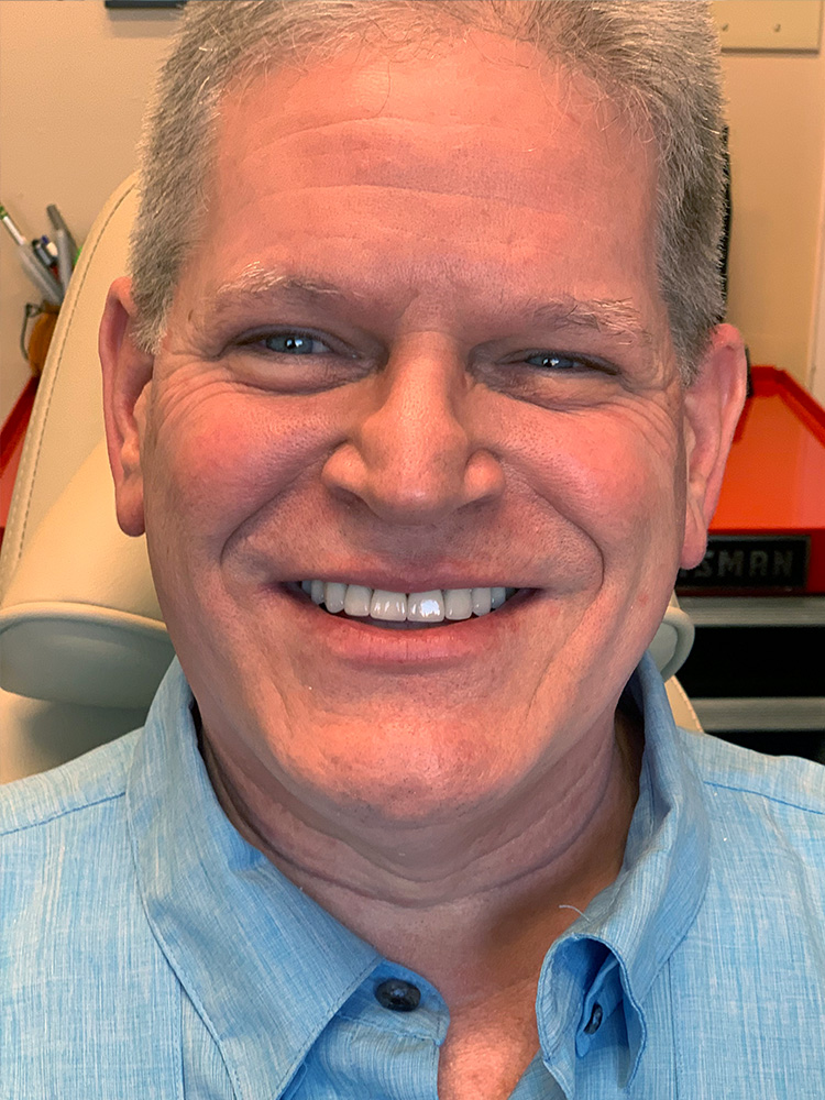 Dental Crown Patient in Shreveport, LA at Shreveport Dental Solutions