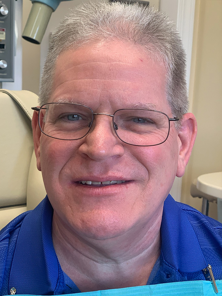 Dental Crown Patient in Shreveport, LA at Shreveport Dental Solutions