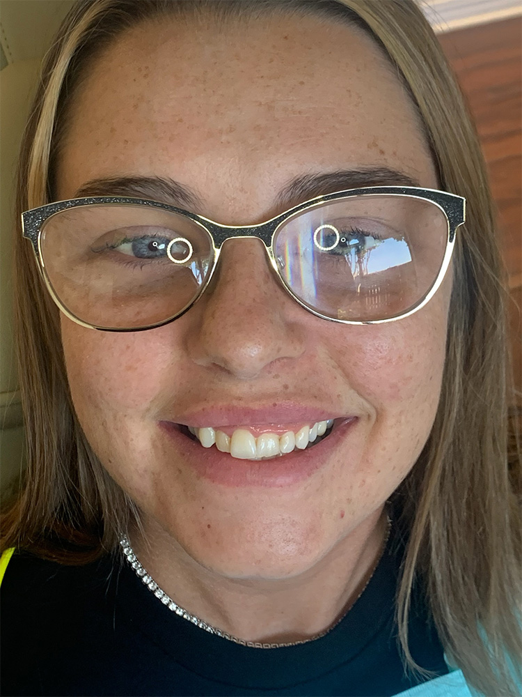 Dental Crown Patient in Shreveport, LA at Shreveport Dental Solutions