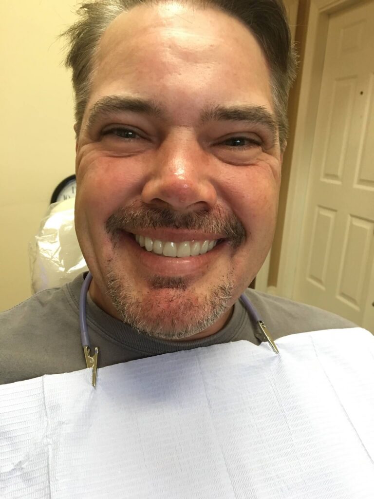 Dental Implant Patient in Shreveport, LA at Shreveport Dental Solutions