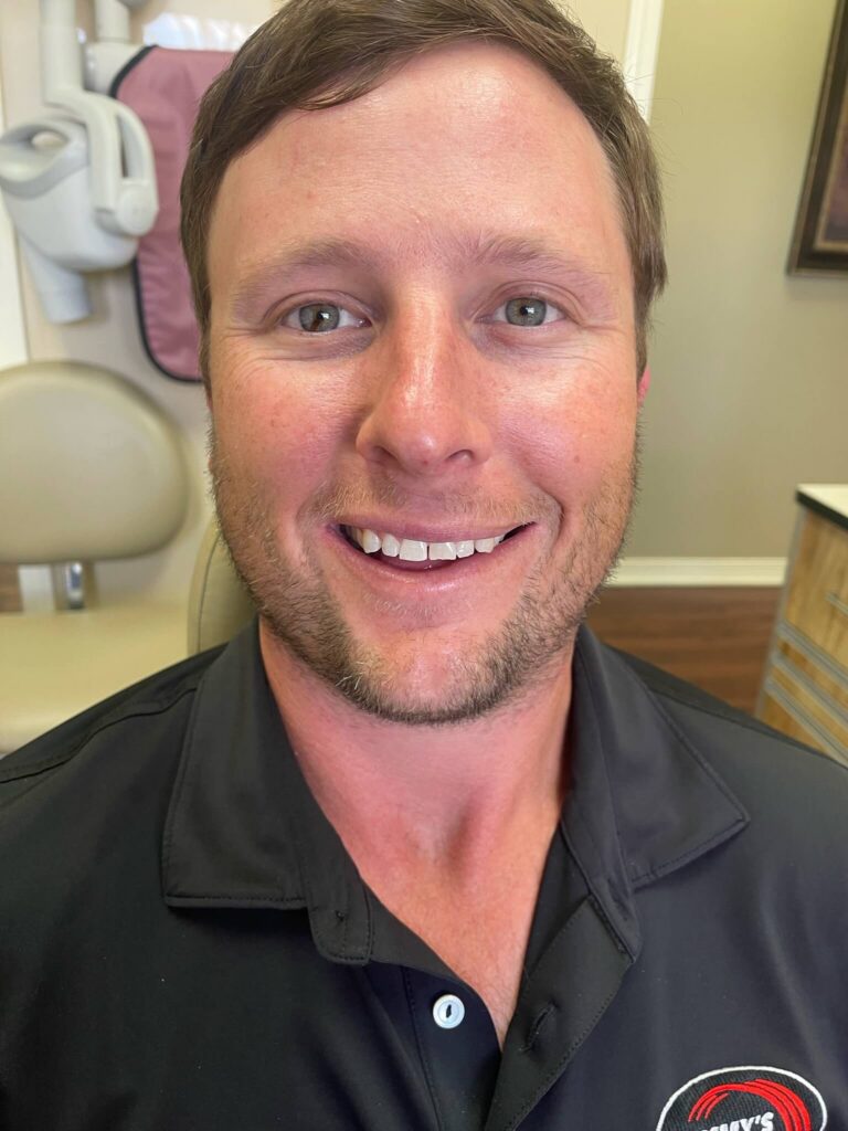 Dental Veneers Patient in Shreveport, LA at Shreveport Dental Solutions