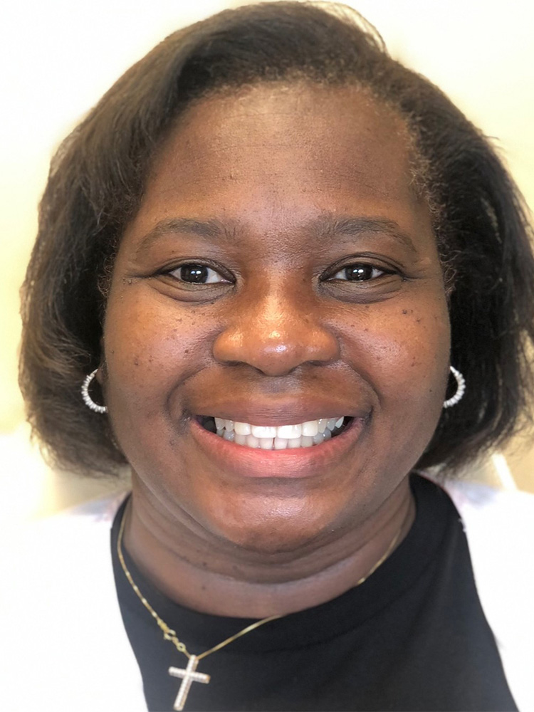 Dental Veneers Patient in Shreveport, LA at Shreveport Dental Solutions