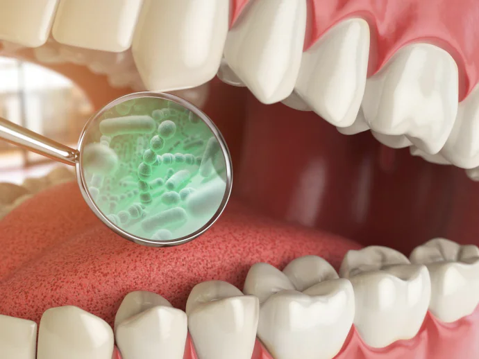 Bad Breath Treatment